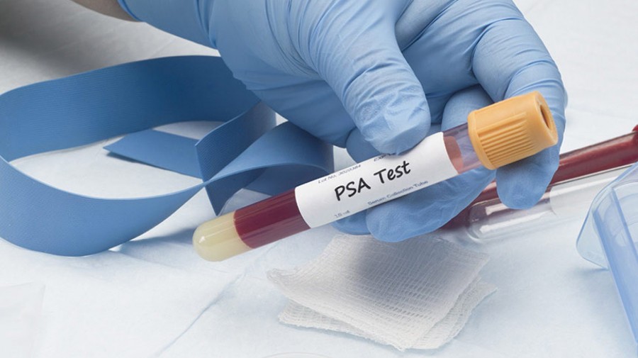 Teste de cancro da próstata