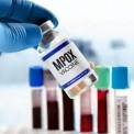 Vacina contra Mpox