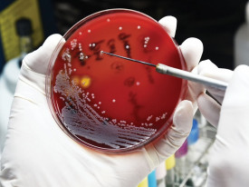 Cientistas descobrem nova classe de antibióticos naturais no corpo humano - DR