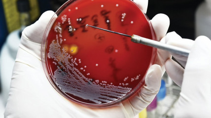 Cientistas descobrem nova classe de antibióticos naturais no corpo humano - DR