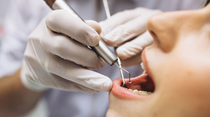 Estudo revela que bactérias da boca podem causar ataques cardíacos - DR