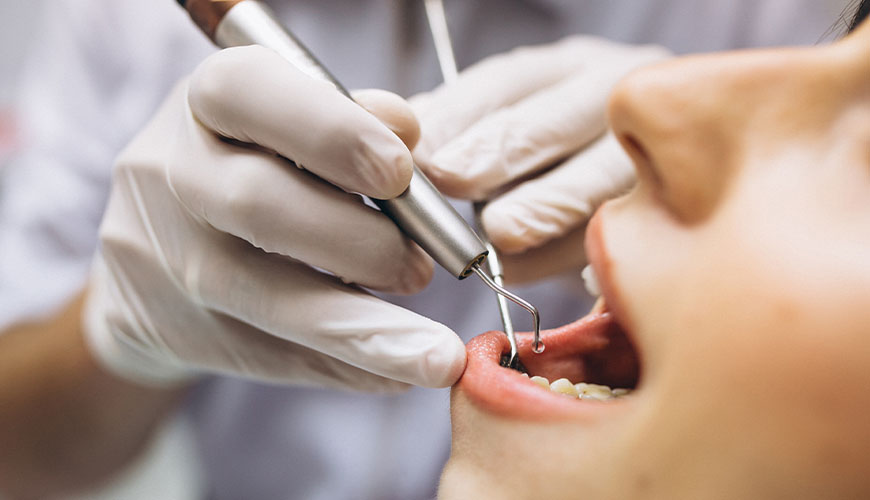 Estudo revela que bact&eacute;rias da boca podem causar ataques card&iacute;acos