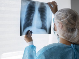 Angola regista mais de 85 mil casos de tuberculose, em 2025 - DR