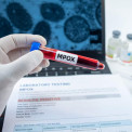 Registados novos casos de Mpox em Angola
