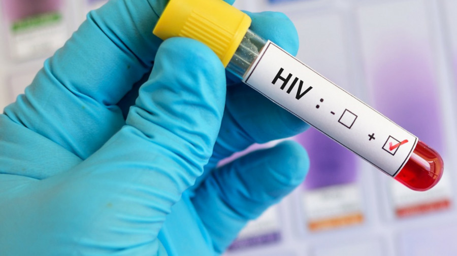 VIH continua a matar anualmente cerca de 44.000 pessoas em Mo&ccedil;ambique