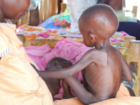 Mais de 450 mil crian&ccedil;as em risco de desnutri&ccedil;&atilde;o no Sud&atilde;o do Sul - DR