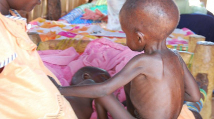 Mais de 450 mil crian&ccedil;as em risco de desnutri&ccedil;&atilde;o no Sud&atilde;o do Sul