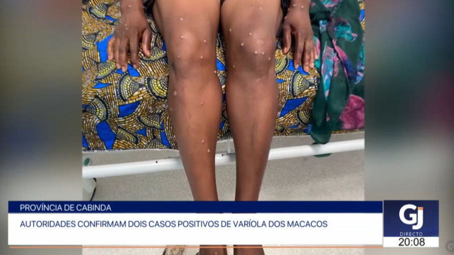 Redac&ccedil;&atilde;o